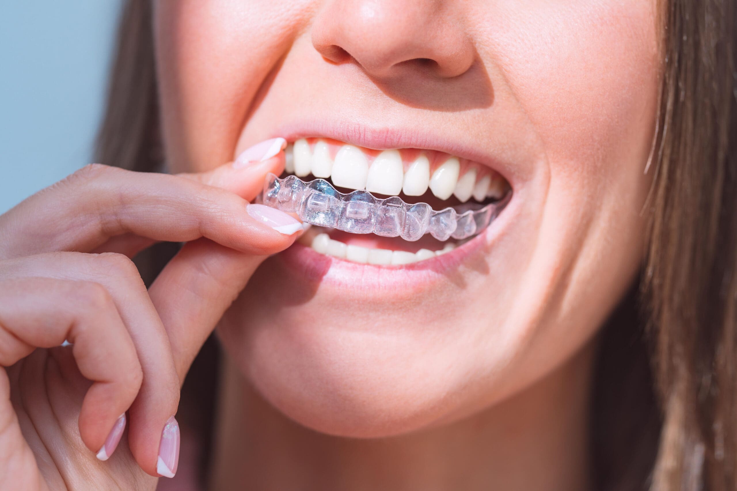 Does Invisalign work? Discover effective treatment options at Lee Family Dentistry in Frederick, MD. Call 301-662-0300 for more info.